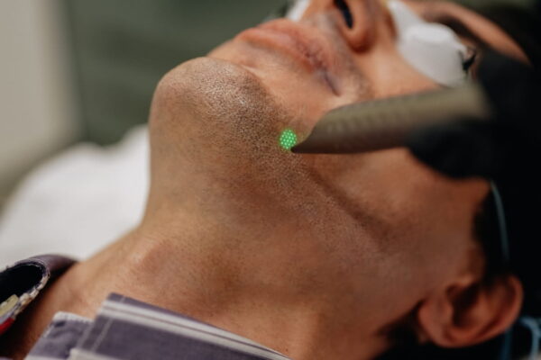 Lasers_for_dermatology_treatment